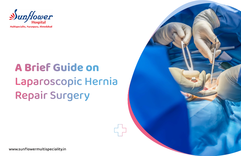 A Brief Guide on Laparoscopic Hernia Repair Surgery